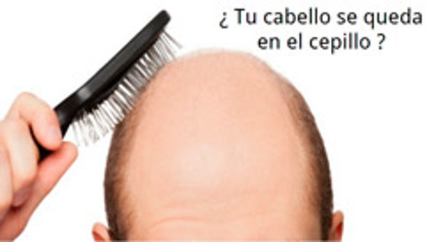 Franquicia Neugger Franquicia Neugger
